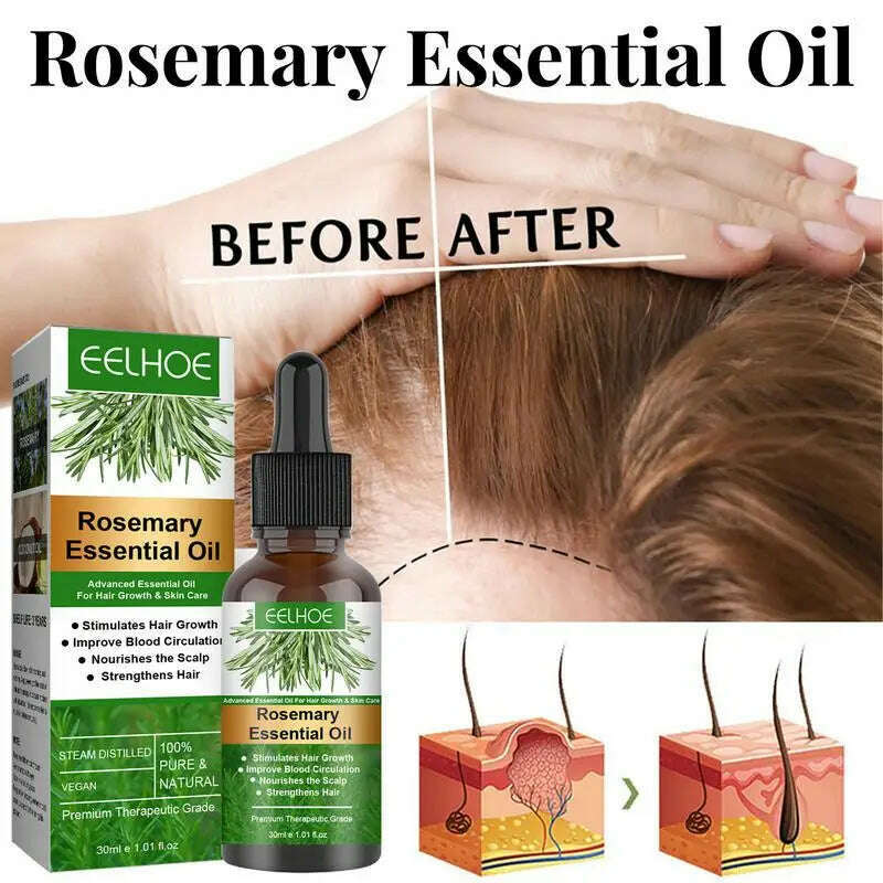 KIMLUD, 30ml Hair Growth Rosemary Oil Fast Growing Hair Essential Oil Beauty Hair Care Prevent Hair Loss Scalp For Men Women, KIMLUD Womens Clothes