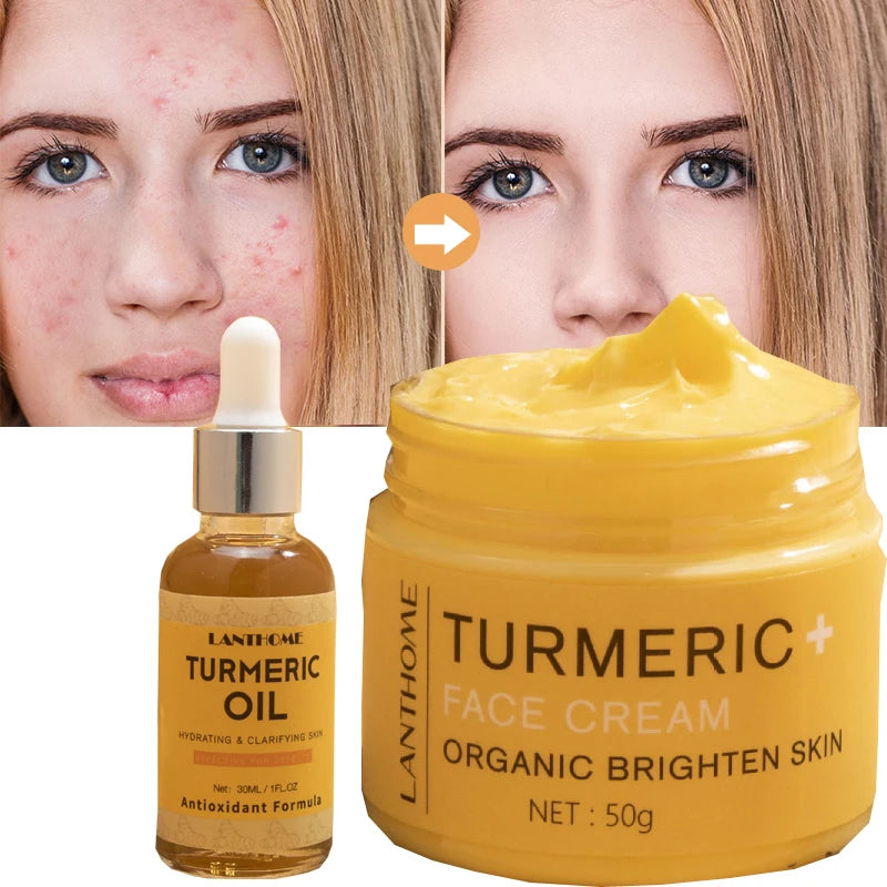 Turmeric Skin Care Set Shrink Pores Moisturizing Whitening Facial Oils Nourish Smooth Face Acne Brightening Cream For Age Spots - KIMLUD