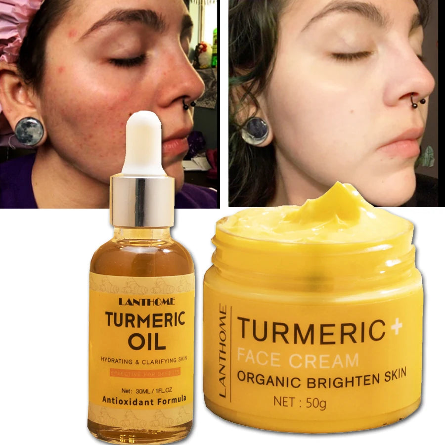 Turmeric Skin Care Set Shrink Pores Moisturizing Whitening Facial Oils Nourish Smooth Face Acne Brightening Cream For Age Spots - KIMLUD