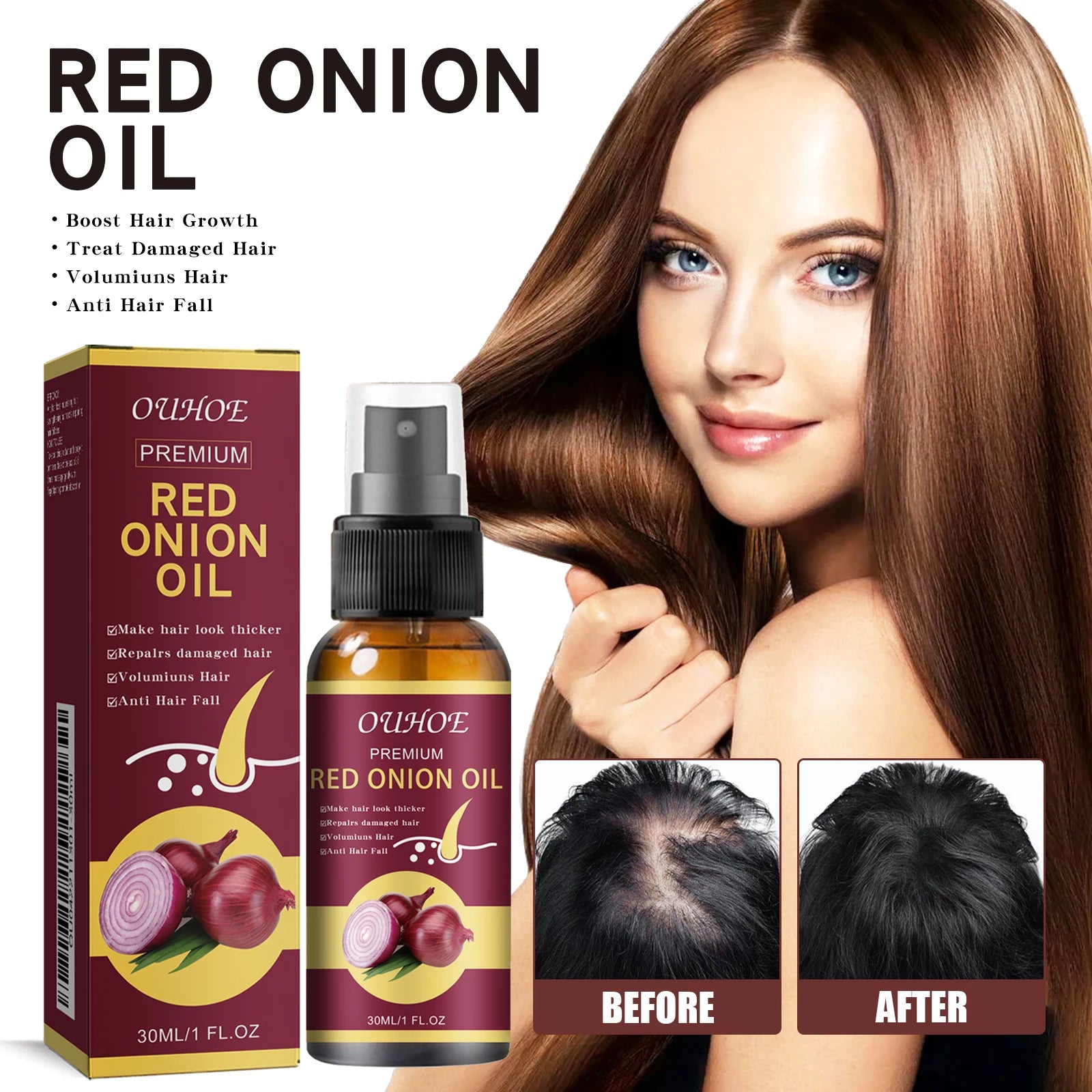 Red Onion Hair Growth Essential Oil Hair Care Spray Prevent Hair Loss Nourish Hair Roots Improve Hair Texture Hair Care Products