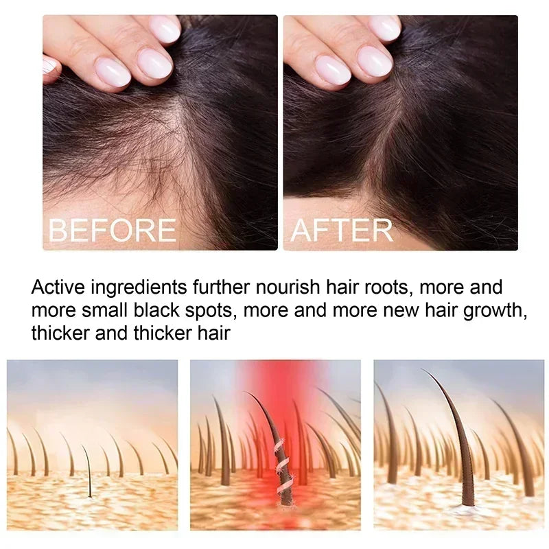 Hair growth fast essential oils, hair care and growth, prevent hair loss 2024