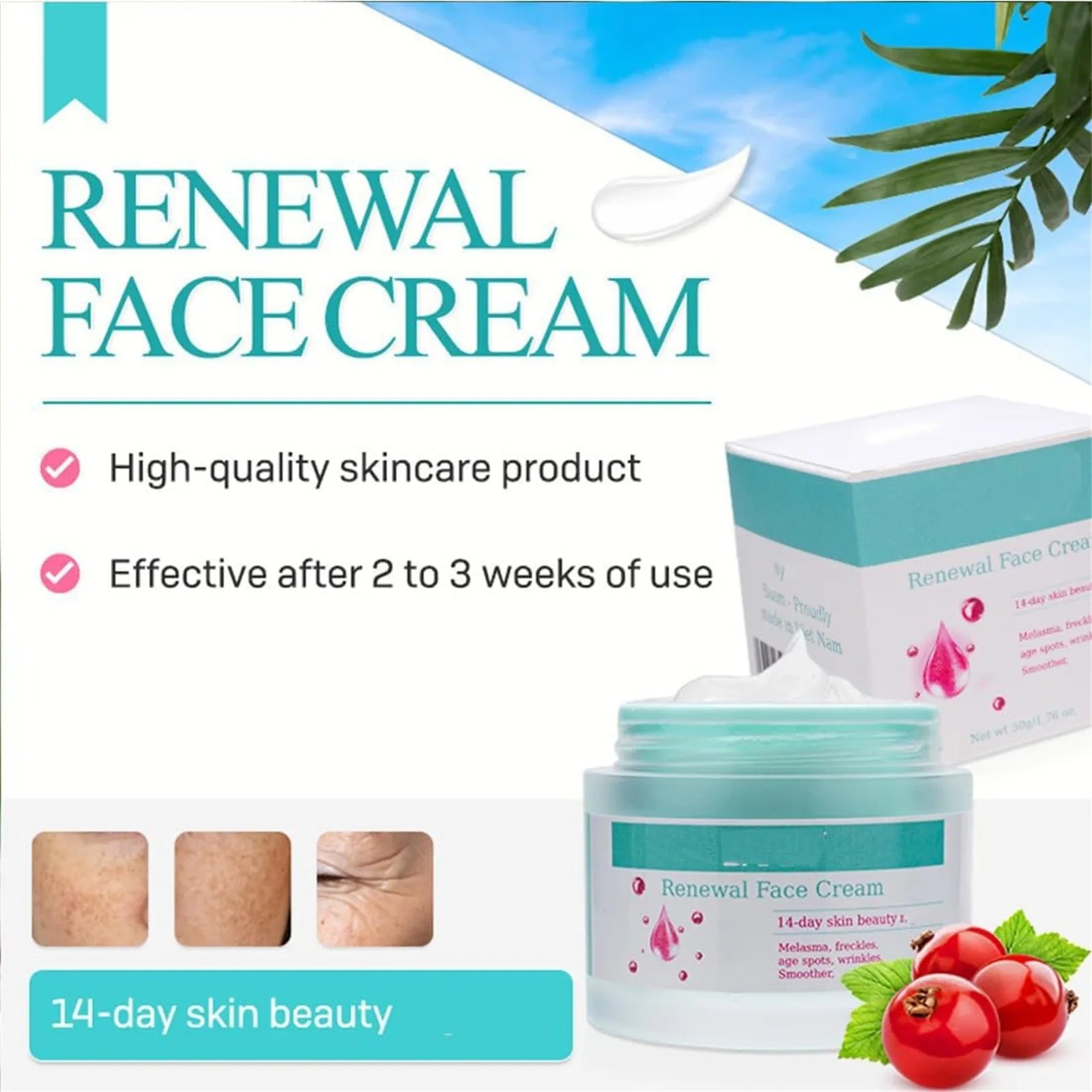 New Cream For Melasma, Nourishing And Moisturizing Skin Face Cream Anti-Wrinkle Reduces Dark Spots And Fine Lines - KIMLUD