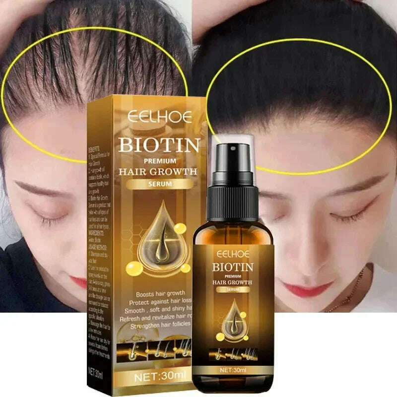 KIMLUD, Biotin Fast Hair Growth Products Anti Hair Loss Serum Spray Prevent Baldness Treatment Scalp Beard Beauty Hair Care Men Women, KIMLUD Womens Clothes