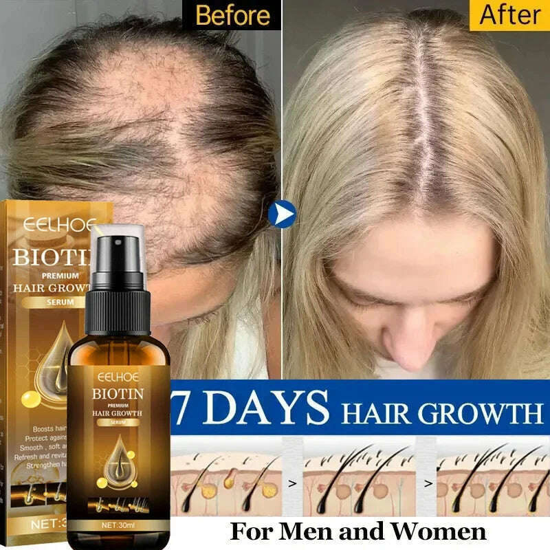 KIMLUD, Biotin Fast Hair Growth Products Anti Hair Loss Serum Spray Prevent Baldness Treatment Scalp Beard Beauty Hair Care Men Women, KIMLUD Womens Clothes