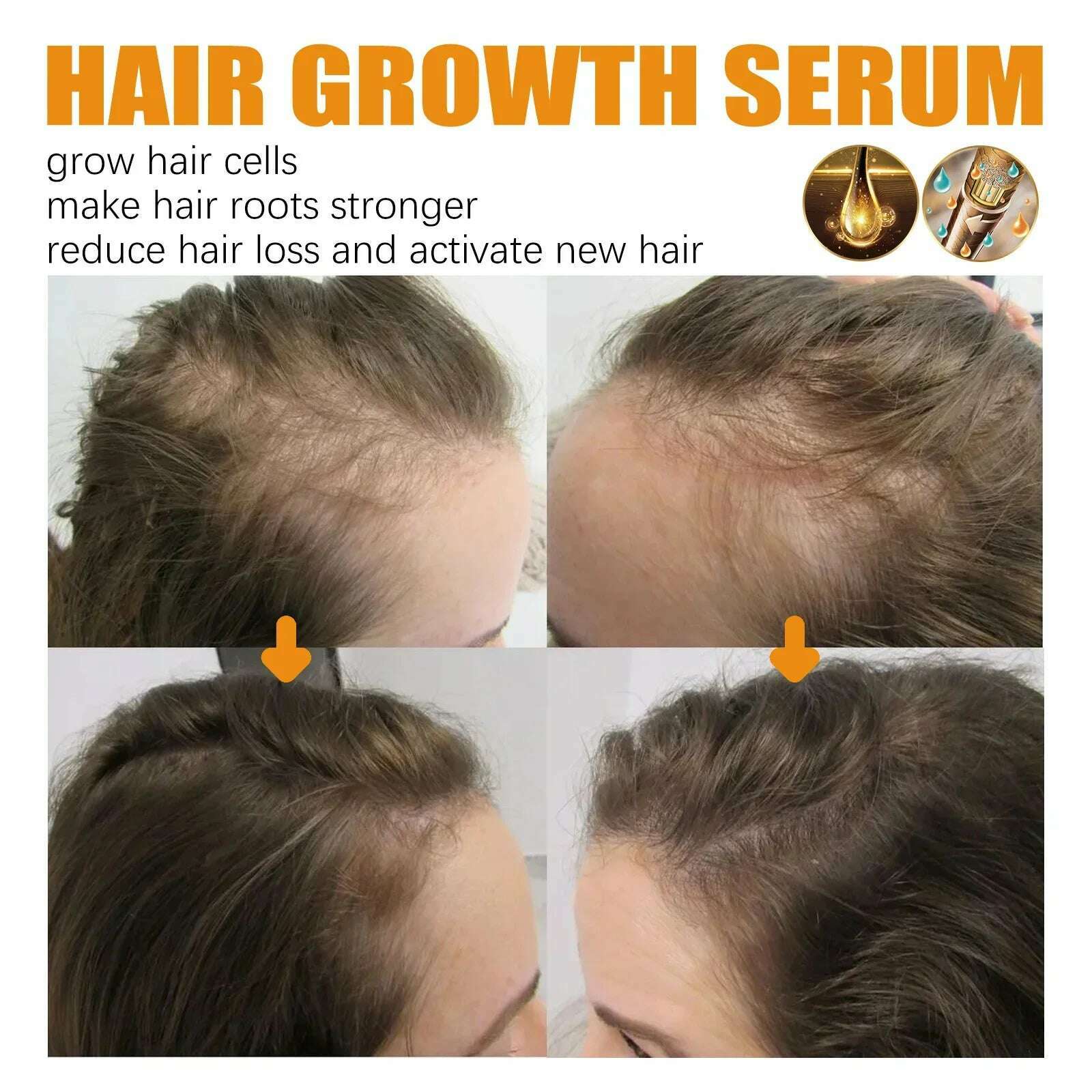 KIMLUD, Biotin Fast Hair Growth Products Anti Hair Loss Serum Spray Prevent Baldness Treatment Scalp Beard Beauty Hair Care Men Women, KIMLUD Womens Clothes