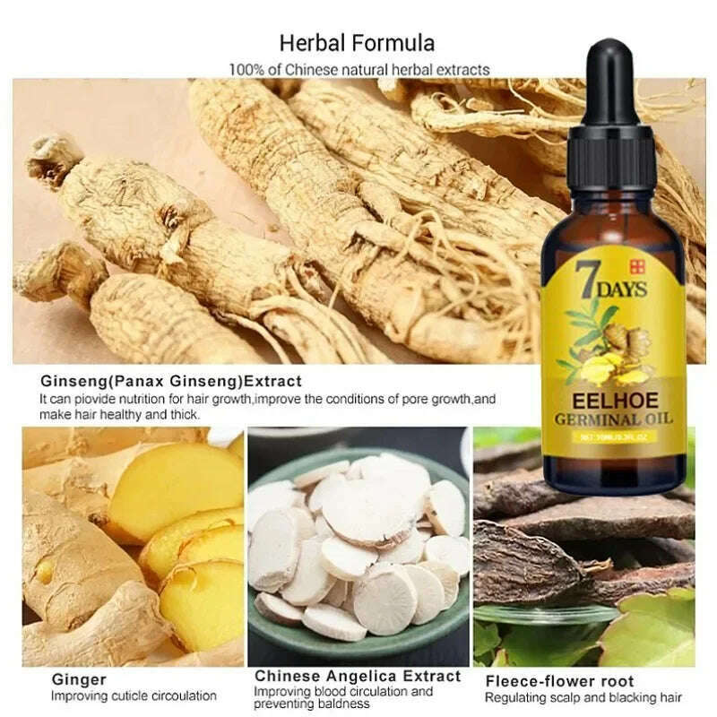 KIMLUD, Fast Hair Growth Ginger Growth Hair Oil Treatment Anti Hair Loss Men Women Scalp Treatment Serum Products Beauty Health, KIMLUD Womens Clothes