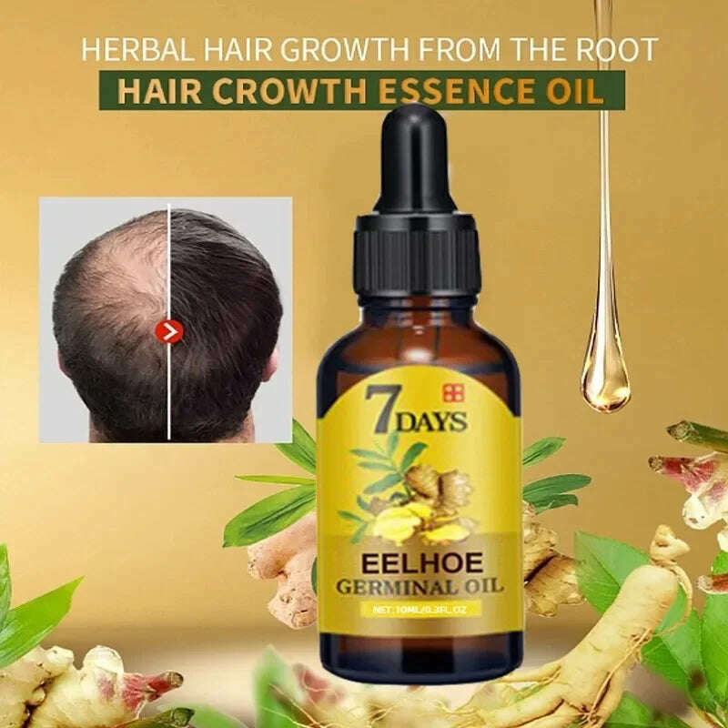 KIMLUD, Fast Hair Growth Ginger Growth Hair Oil Treatment Anti Hair Loss Men Women Scalp Treatment Serum Products Beauty Health, KIMLUD Womens Clothes