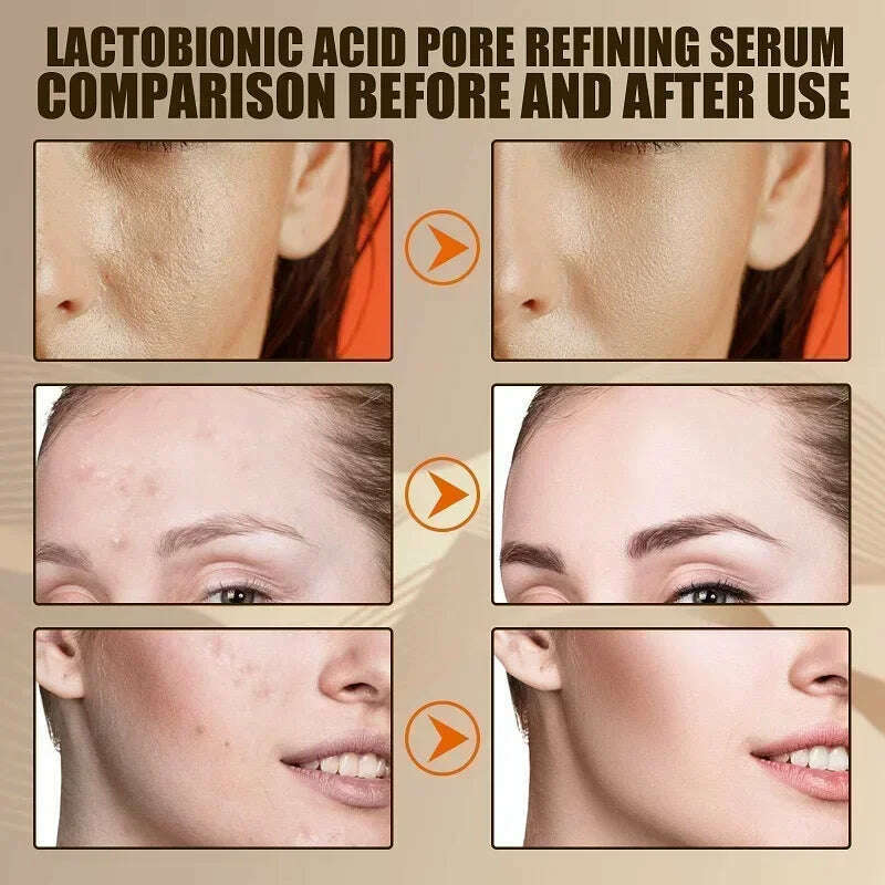 Lactobionic Acid Shrink Pores Facial Serum Firm Moisturizing Essence Liquid Repair Face Pores Beauty Skin Care Korean Cosmetics - KIMLUD