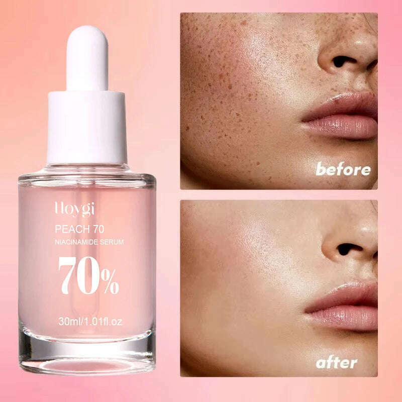 Peach 70% Niacinamide Serum 30ml Moisturizing Prevent Dryness Facial Essential Oil Increasing Elasticity Smooth Soften Skin Care - KIMLUD